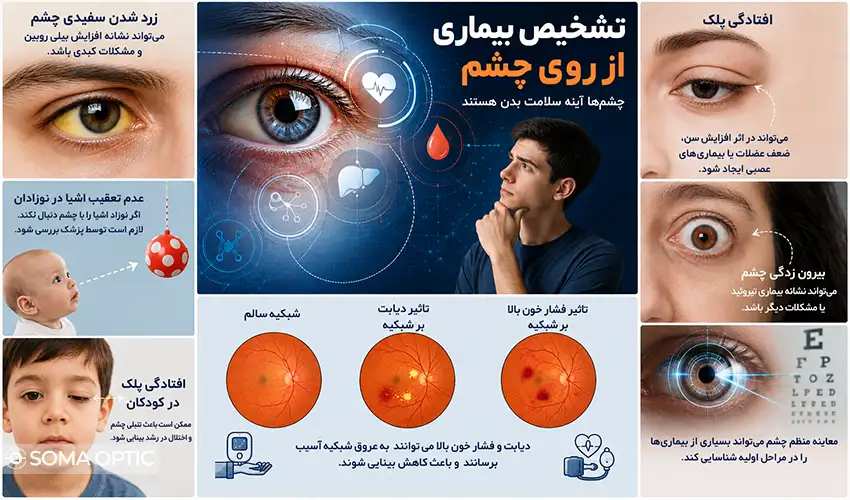 اینفو تشخیص بیماری از روی چشم